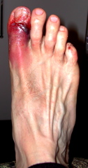 Post-Race Toe